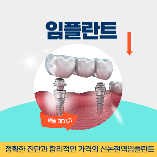 순천치과 순천시 치과 임플란트
