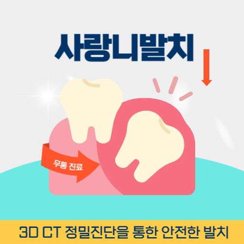 순천치과 순천시 치과 사랑니 발치
